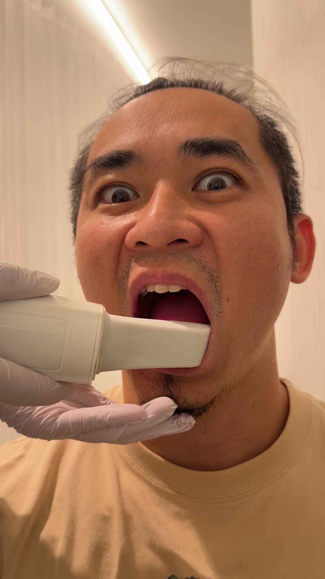 口腔内スキャナーで歯を読み取っている様子