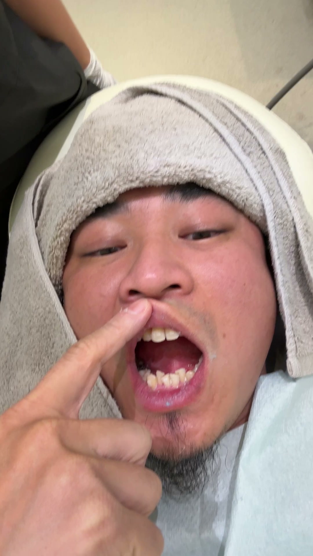 下の歯の重なりを指しながら説明している写真